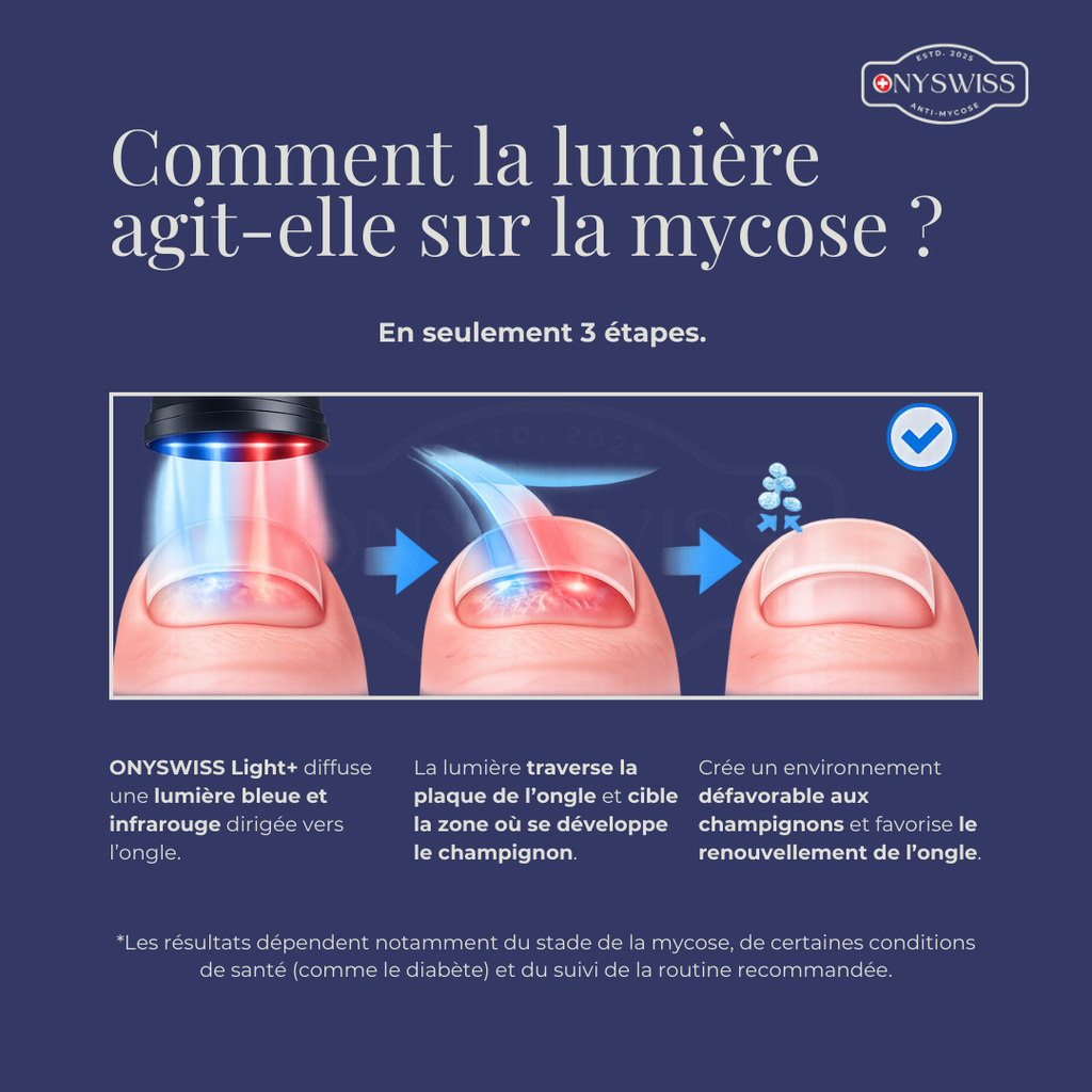 ONYSWISS Light+ – La lumière qui redonne vie et beauté à vos ongles