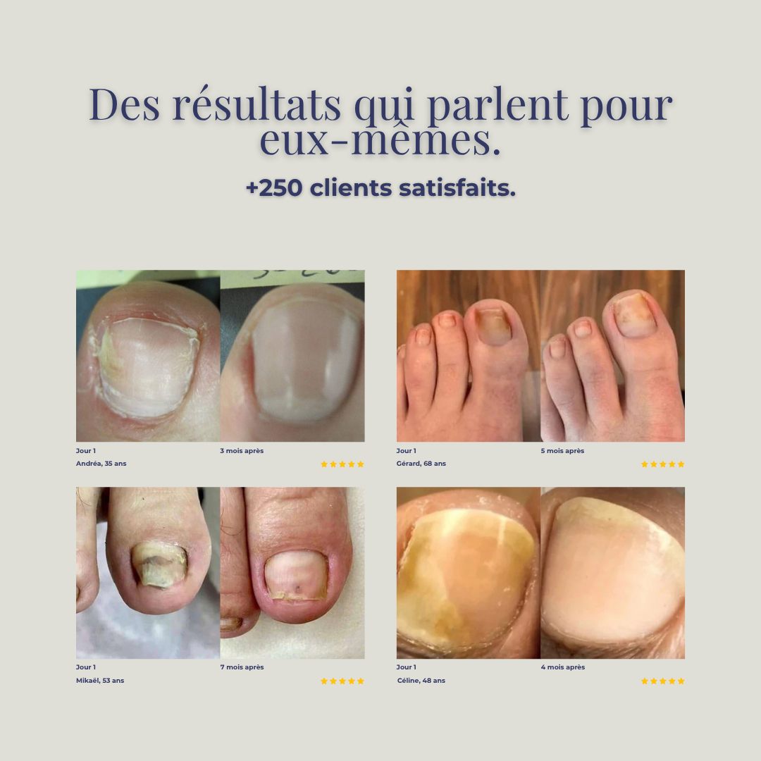 ONYSWISS Light+ – La lumière qui redonne vie et beauté à vos ongles
