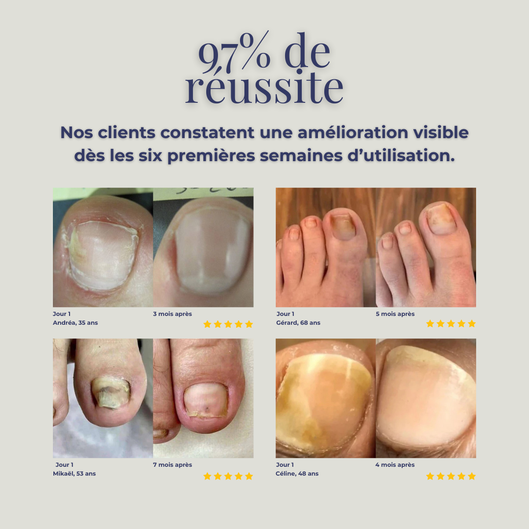 ONYSWISS Light+ – La lumière qui redonne vie et beauté à vos ongles