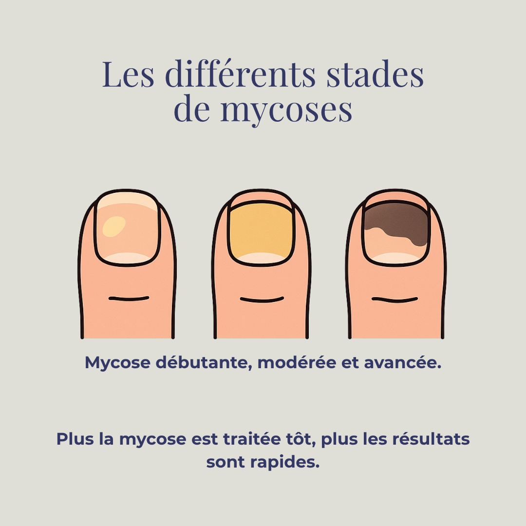 ONYSWISS Light+ – La lumière qui redonne vie et beauté à vos ongles